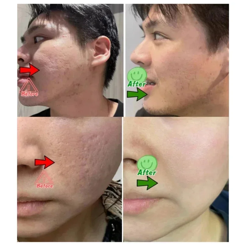 Crema per la pulizia dei pori  - Korean Lifestyle Products recensione e prezzo